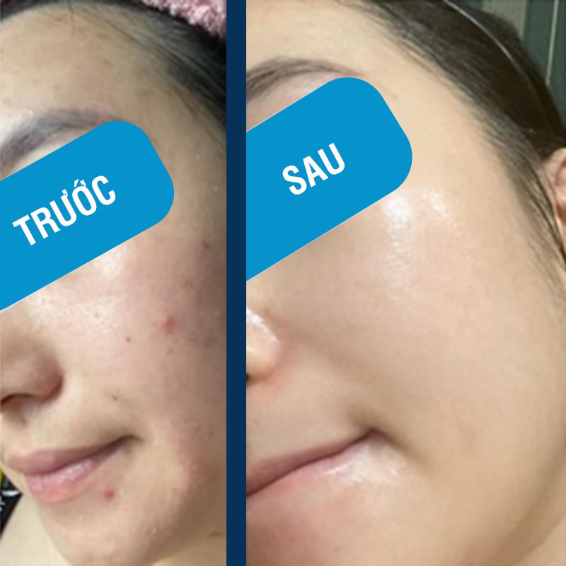 Mặt Nạ B5 EGF Complex Mask Kr Lab Cấp Ẩm (1 miếng x 25ml)