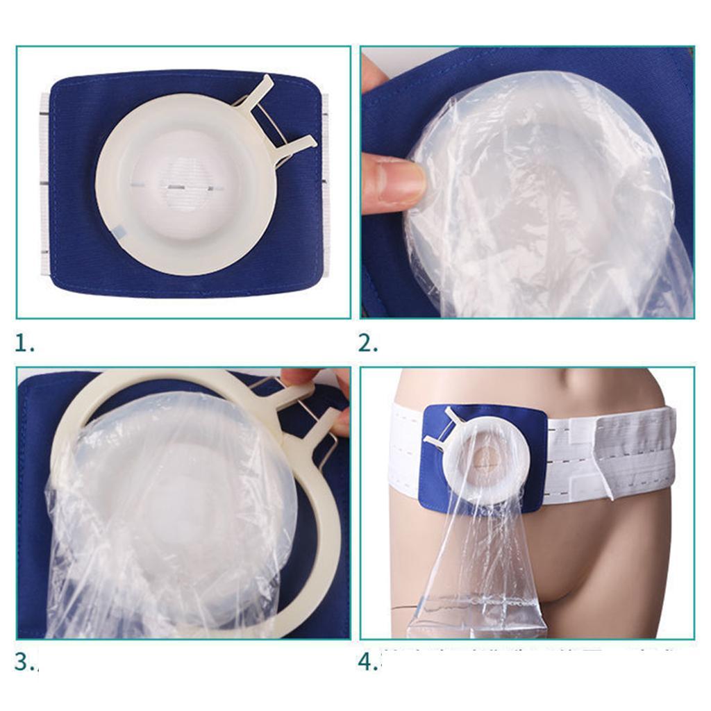 Support Abdominal Belt Adjustable Colostomy Ileostomy Surgery for Hernia Belt Ostomy Belt