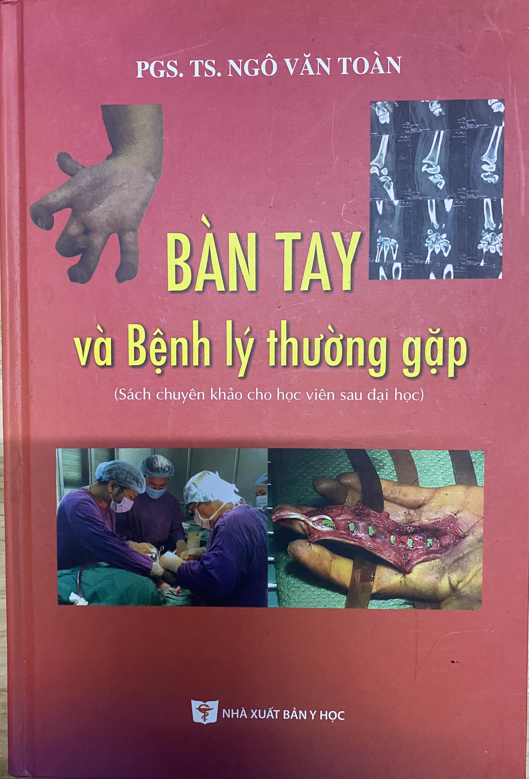 Sách- Bàn tay và Bệnh lý thường gặp