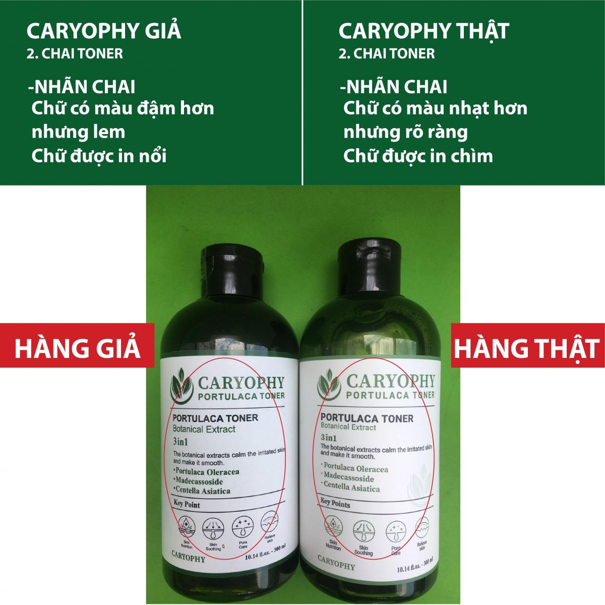 Toner Ngăn Ngừa Mụn Caryophy