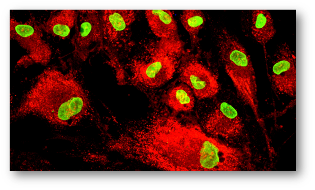 Immunomodulation MSC Assay - KIỂM SOÁT CHẤT LƯỢNG