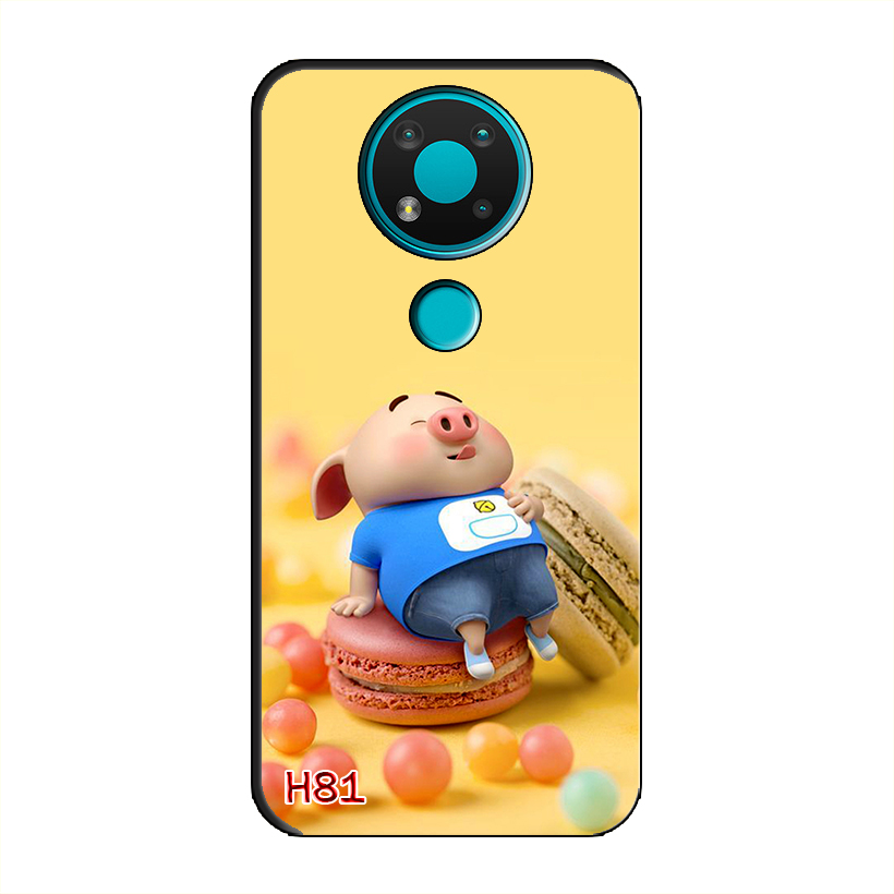 Ốp Dẻo Dành Cho NOKIA 3.4