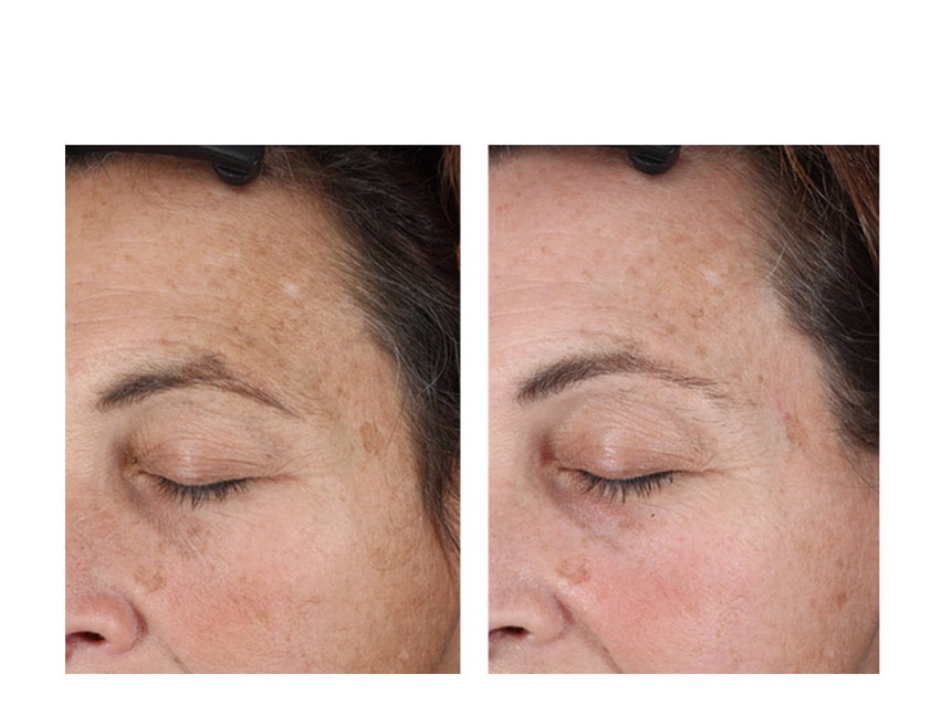 Serum làm sáng & ngăn ngừa tăng sắc tố da NeoStrata Enlighten Illuminating Serum 30ml