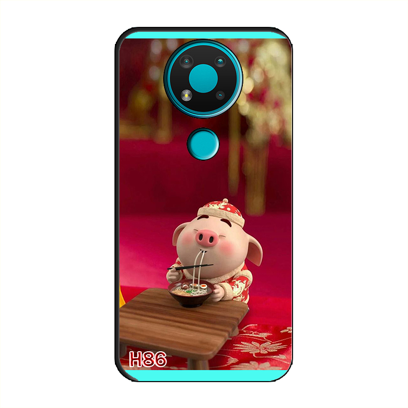 Ốp Dẻo Dành Cho NOKIA 3.4