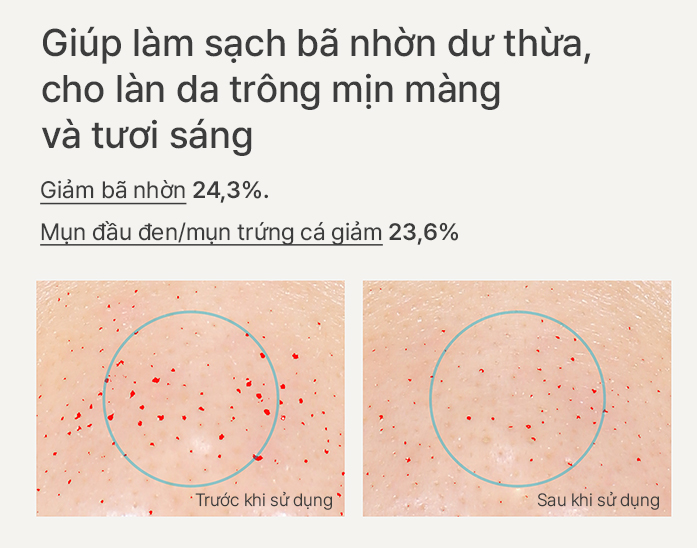 Tinh chất dưỡng phục hồi da innisfree Retinol Cica Repair Ampoule 30 mL