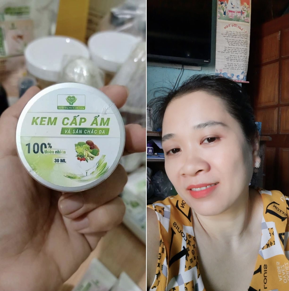 Kem Cấp Ẩm & Săn Chắc Da MẸ KEN 30ml - kem cẩm ẩm cho da