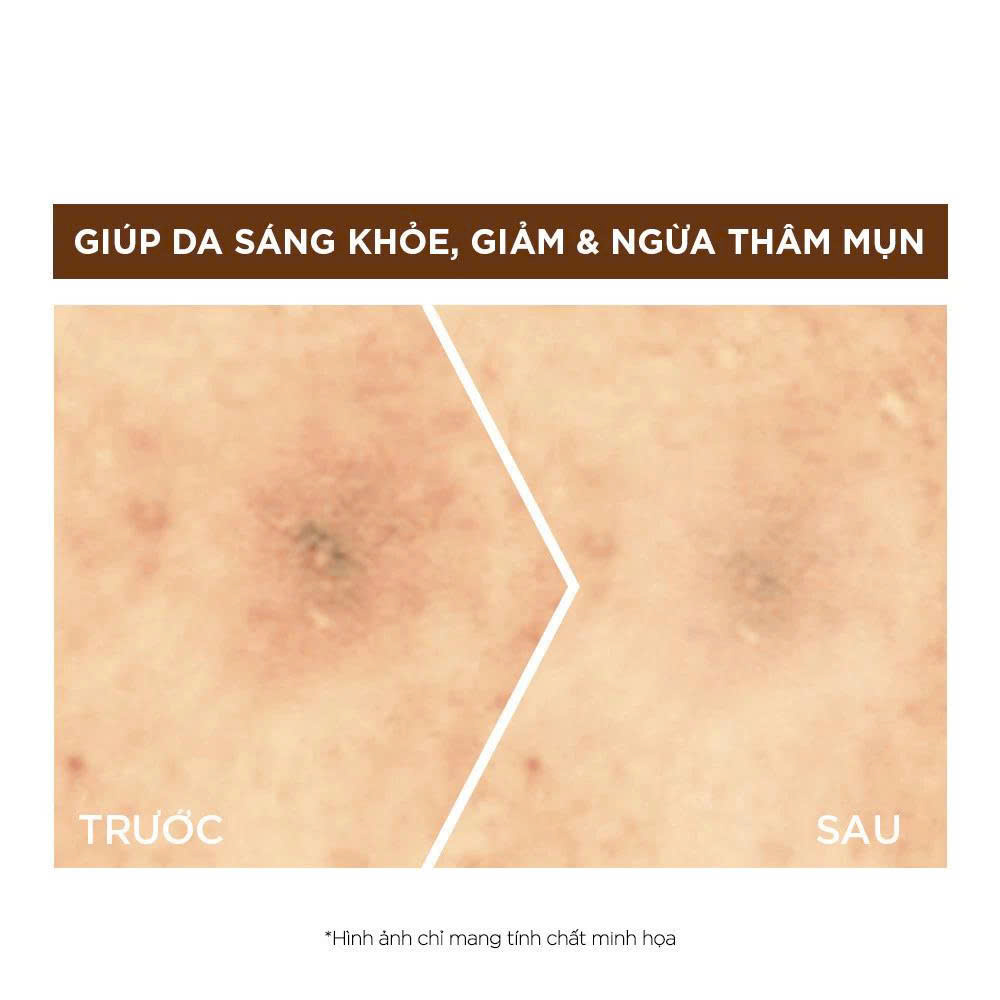 Dưỡng chất ban đêm dưỡng sáng &amp; phục hồi Garnier 10% Vitamin C Nguyên Chất Bright Complete Overnight Serum 30ml