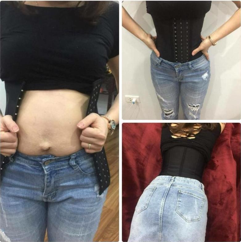 Đai Gen Nịt Bụng 9 Xương Latex MP