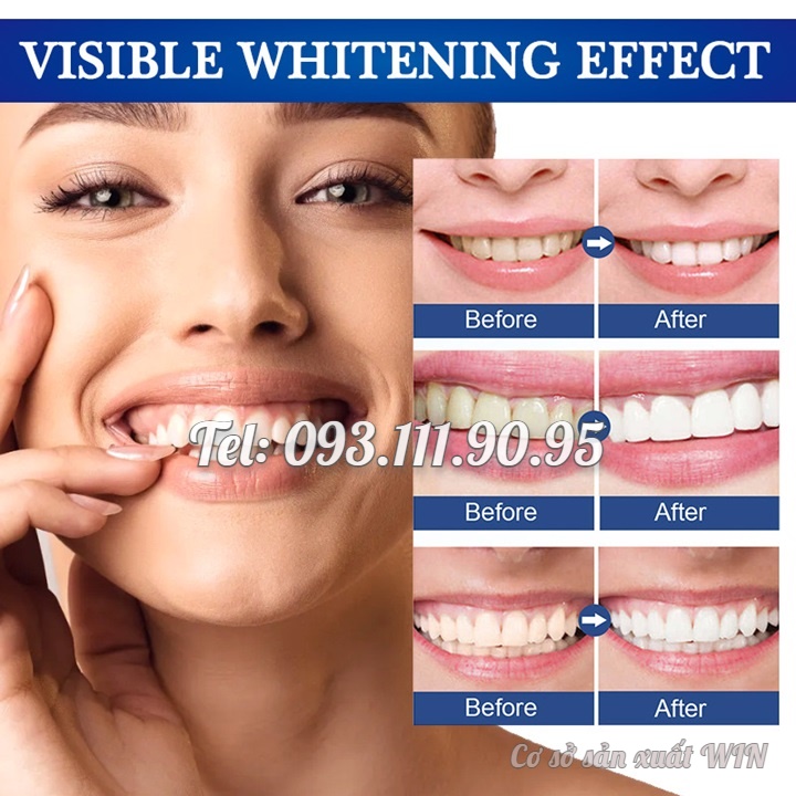Gel bôi làm trắng, sáng răng, giảm ố vàng, cao răng, giảm hôi miệng và giúp hơi thở thơm tho xuất xứ Nhật Bản – Mã số 1223