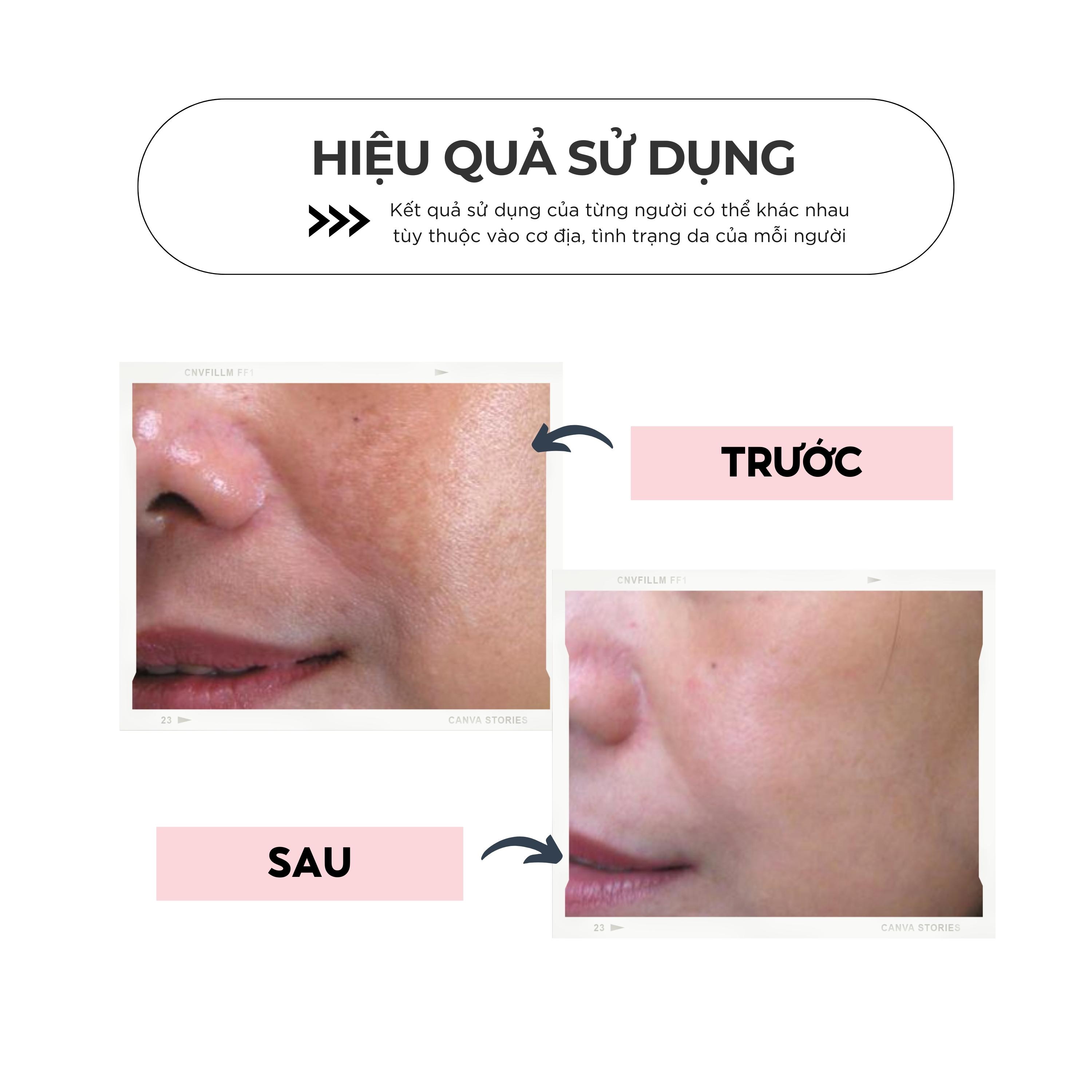 Kem dưỡng trắng da nhân sâm CHARM - Ngăn ngừa nám sạm, mờ dân nếp nhăn, nâng cơ săn chắc da, giúp bạn sở hữu làn da trắng mịn căng bóng