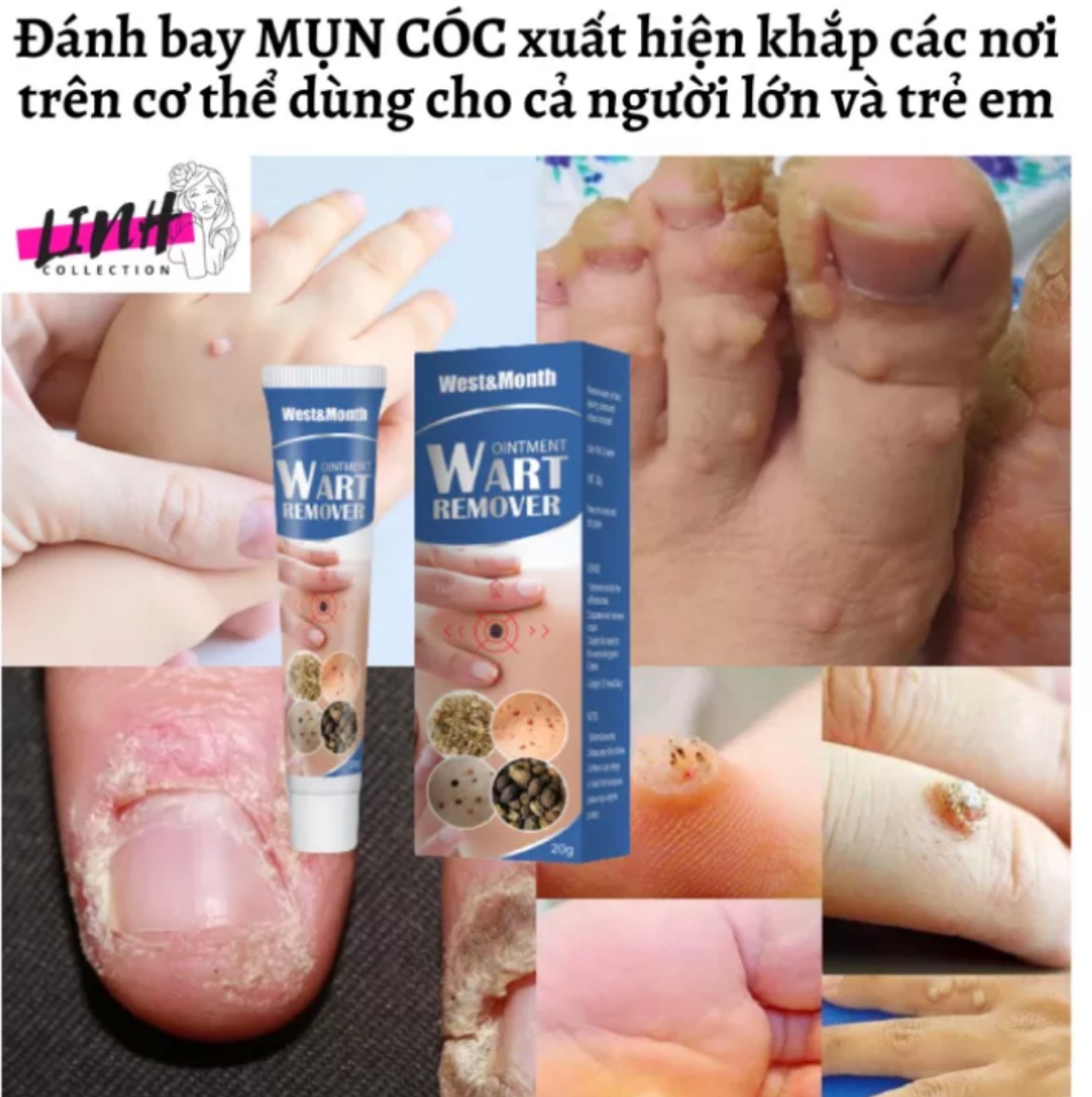 Kem tẩy làm rụng mụn cóc mụn thịt tẩy nốt ruồi hàng chuẩn chất lượng