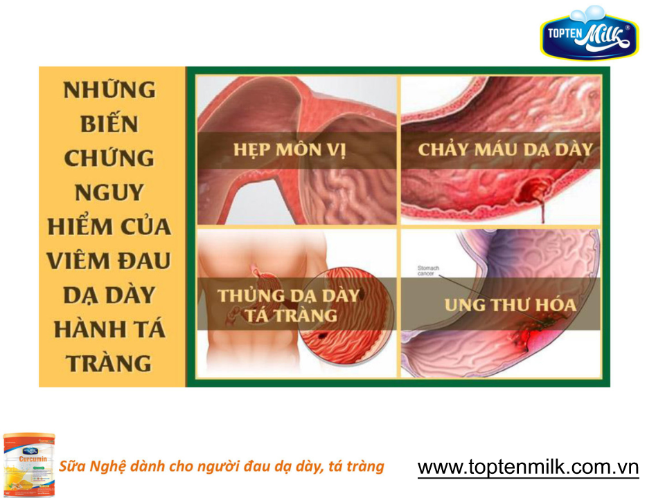 Sữa nghệ curcumin 800g TOPTEN Milk sữa bột cho người bị đau dạ dày tá tràng,phụ nữ sau sinh ,đẹp da