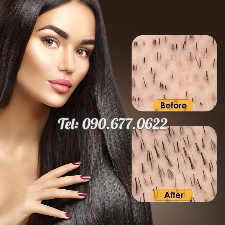 Chai xịt dưỡng kích mọc tóc, giúp tóc mọc dài nhiều và dày, mọc tóc nhanh, bóng, mượt, ngăn rụng tóc xuất xứ Singapore - Mã số 1102