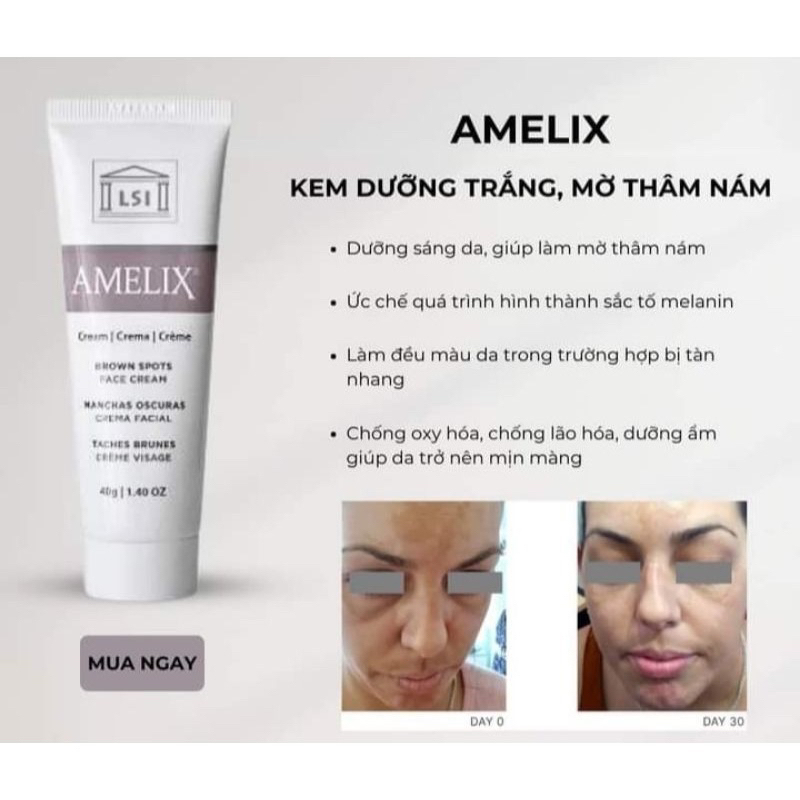 Kem dưỡng trắng mờ thâm nám LSI Amelix Face Cream 40g