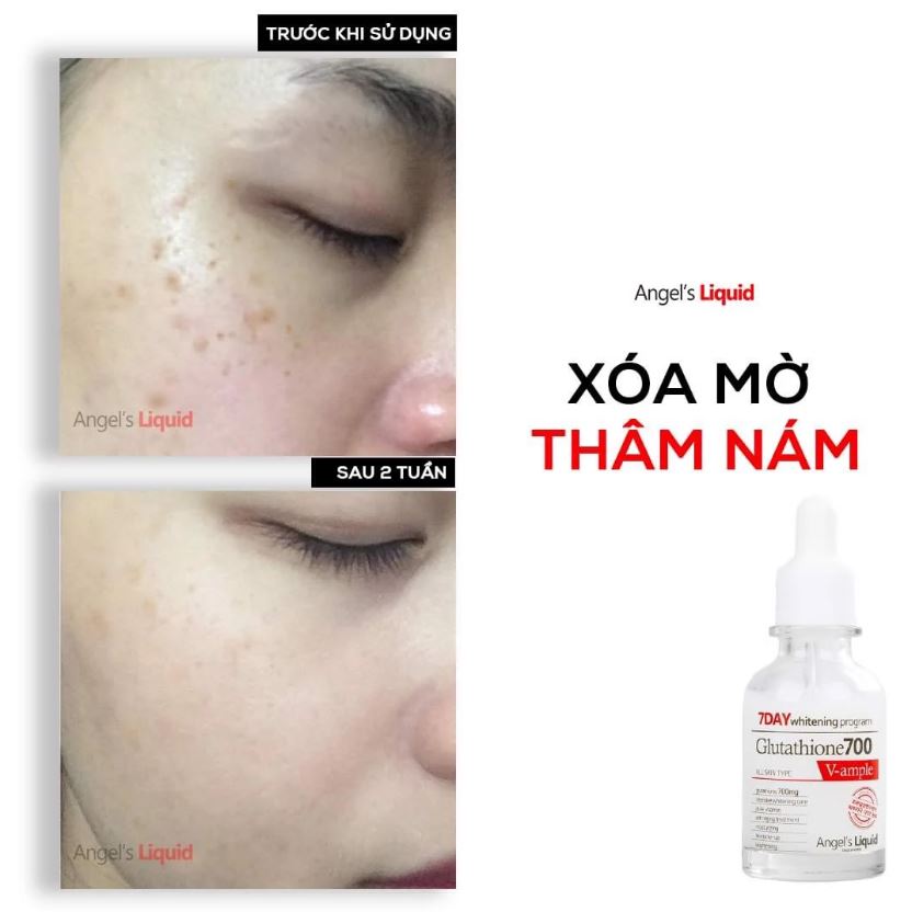 Huyết Thanh Dưỡng Trắng Da, Làm Mờ Thâm Nám Chỉ Trong 7 Ngày Angel's Liquid