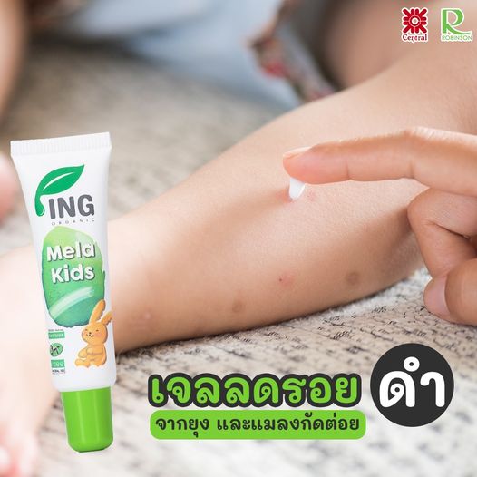 ING ORGANIC NATURE MELA KIDS - SERUM MỜ SẸO THÂM DO MUỖI ĐỐT, ĐẶC VIỆT DO MỤN LÀM THÂM - HIỆU QUẢ SAU 3 NGÀY SỬ DỤNG