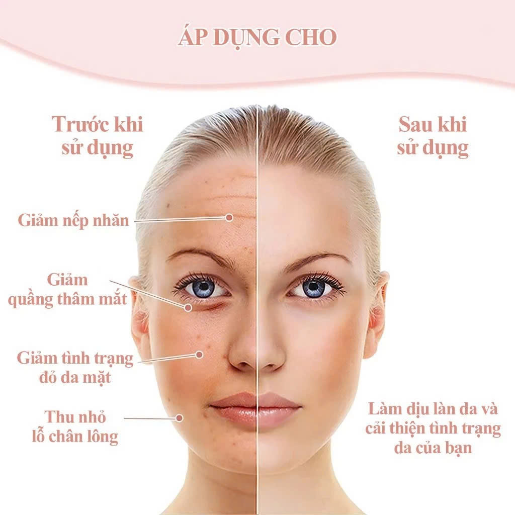 Máy Massage Mặt Làm Đẹp Da Lạnh ICE Giúp Nâng Cơ Mặt, Rửa Sạch Sâu, Tăng Cường Hấp Thụ Tinh Chất Dưỡng Da Kèm Massage Mắt Loại Quầng Thâm Tạo Nét V-Line Cho Mặt - Giao Màu Ngẫu Nhiên