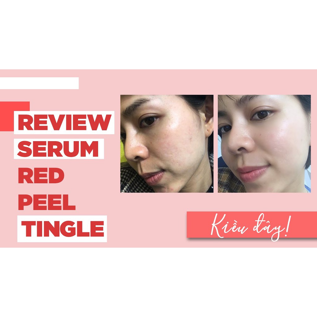 [Mẫu mới 2020] Tinh Chất Tái Tạo và Phục Hồi Da Red Peel Tingle Serum 35ml - Tặng Kèm Cột Tóc Nơ BERAV Handmade Annie Ribbon Giao Màu Ngẫu Nhiên