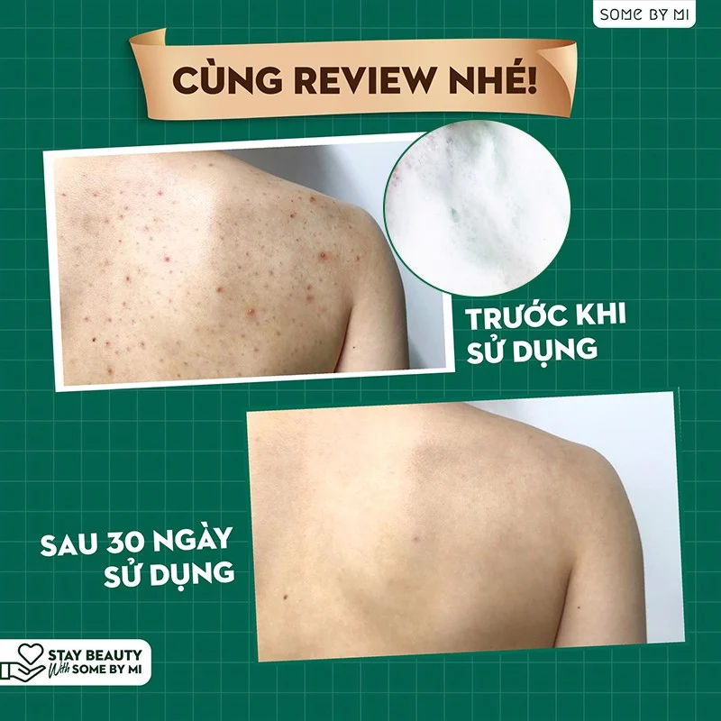 Sữa Tắm Hỗ Trợ Giảm Mụn Lưng Some By Mi AHA-BHA-PHA 30 Days Miracle Acne Clear Body Cleanser 400g