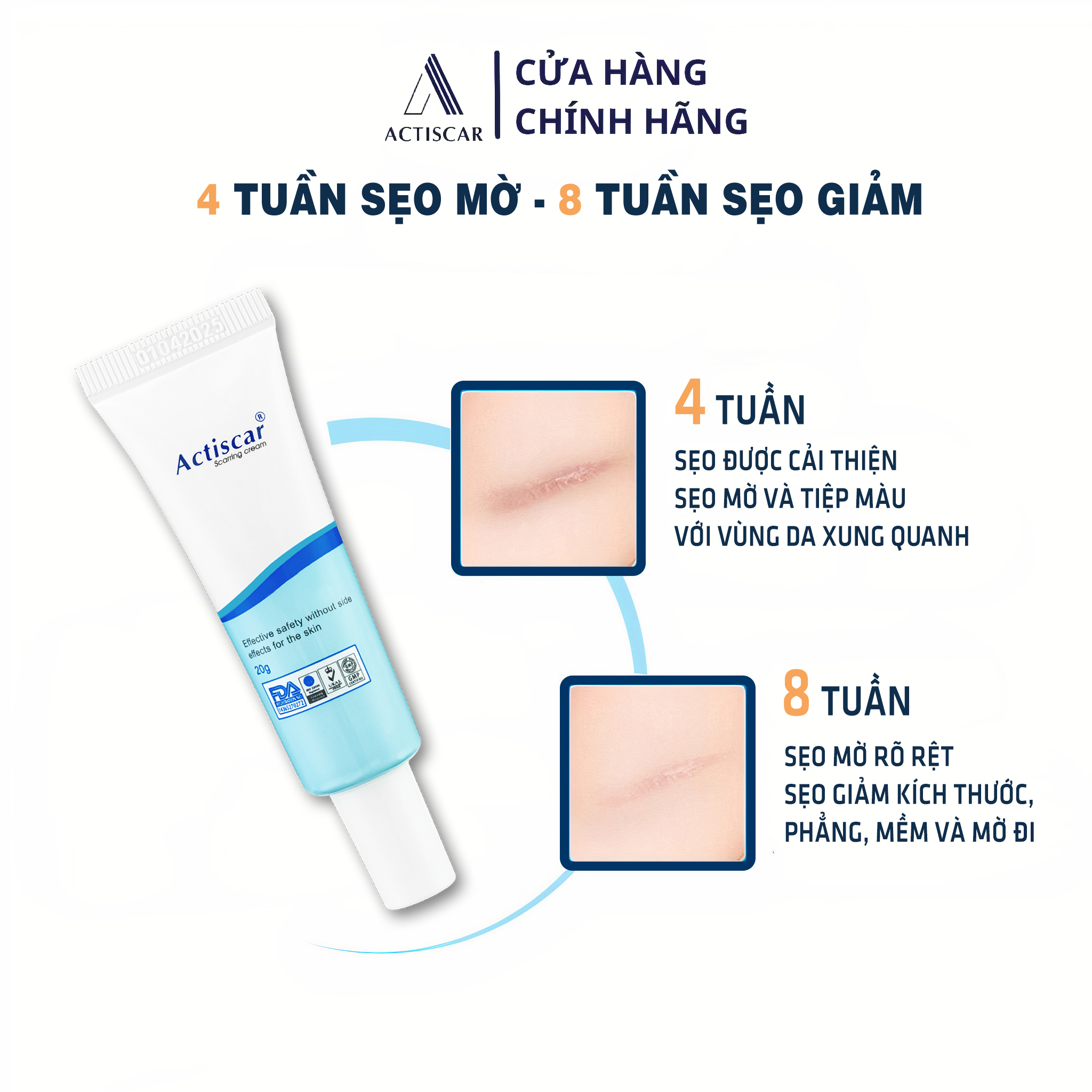 Kem Xoá Mờ Sẹo Actiscar 20g