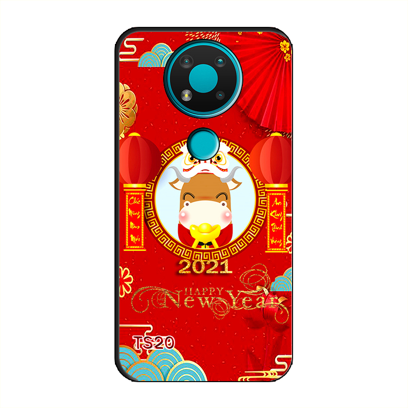 Ốp Dẻo Dành Cho NOKIA 3.4