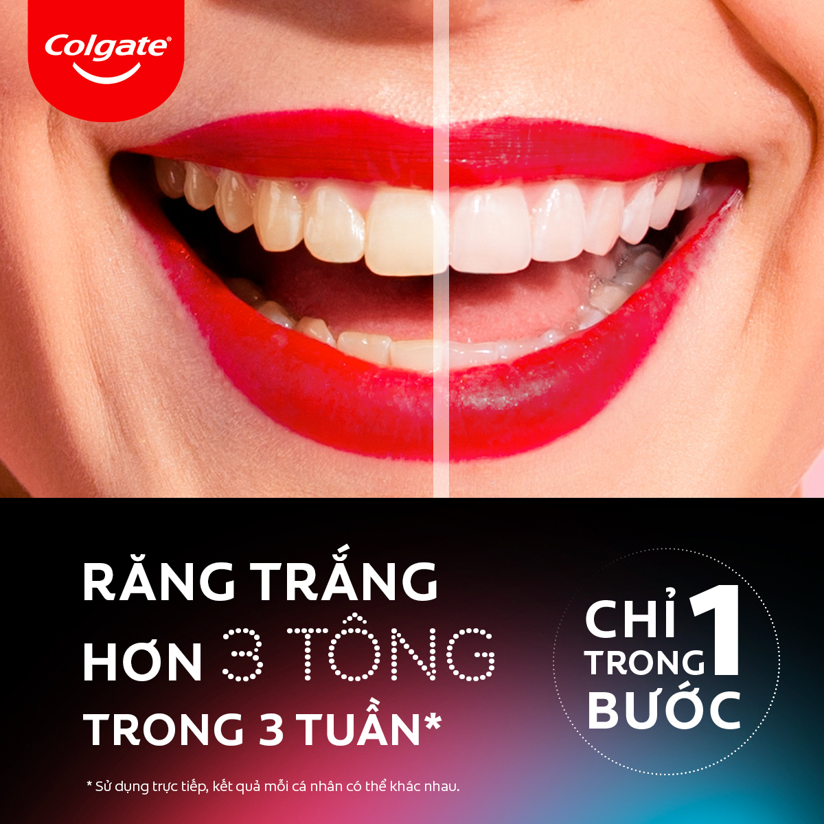 Bút làm trắng răng Colgate Optic White O2 an toàn tại nhà, không ê buốt