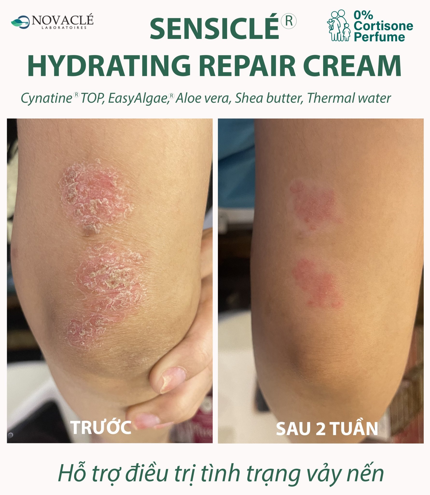 Kem Dưỡng Ẩm Cho Mọi Loại Da Sensiclé - Crème Réparatrice Hydratante