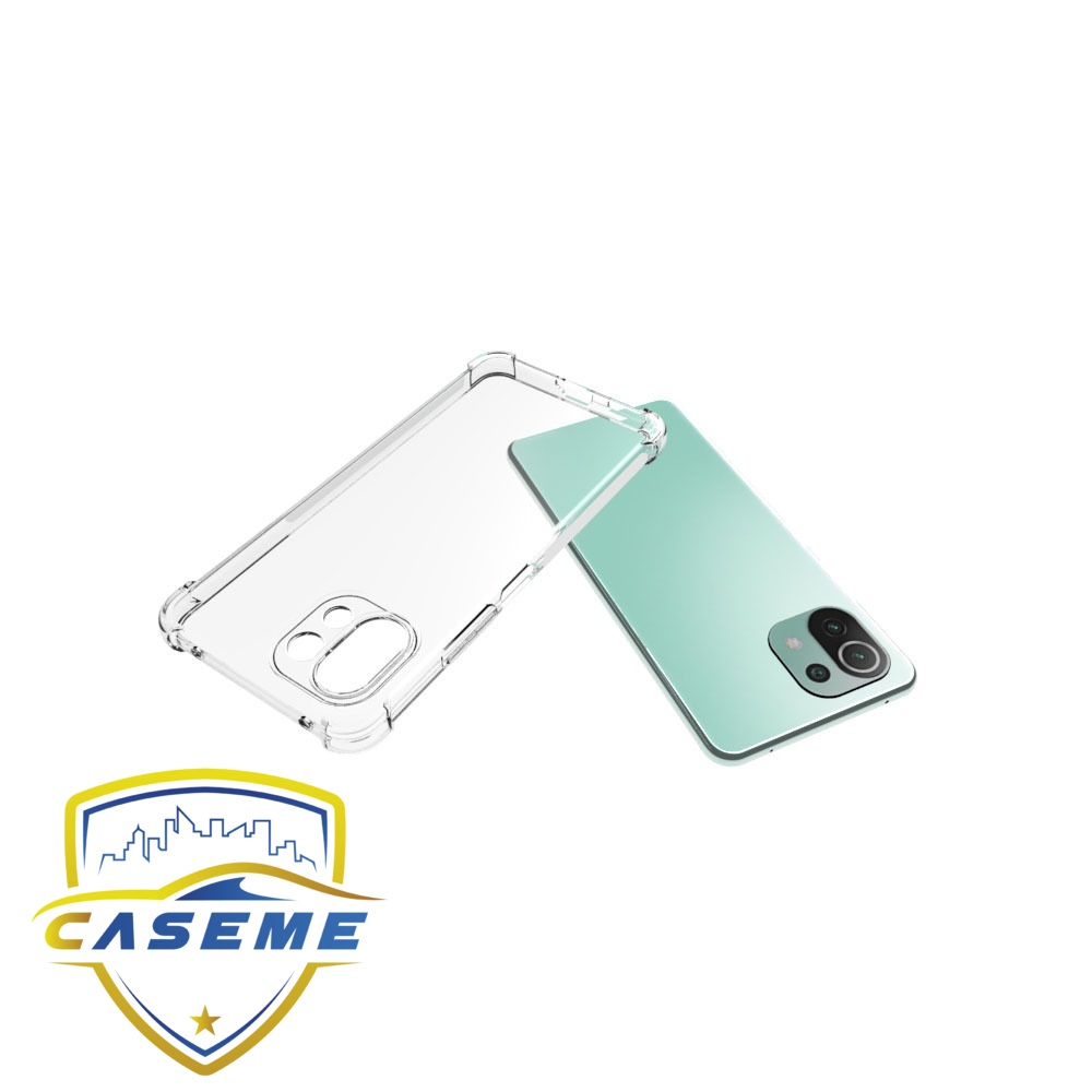Ốp lưng dành cho Xiaomi Mi 11 Pro dẻo trong chống sốc