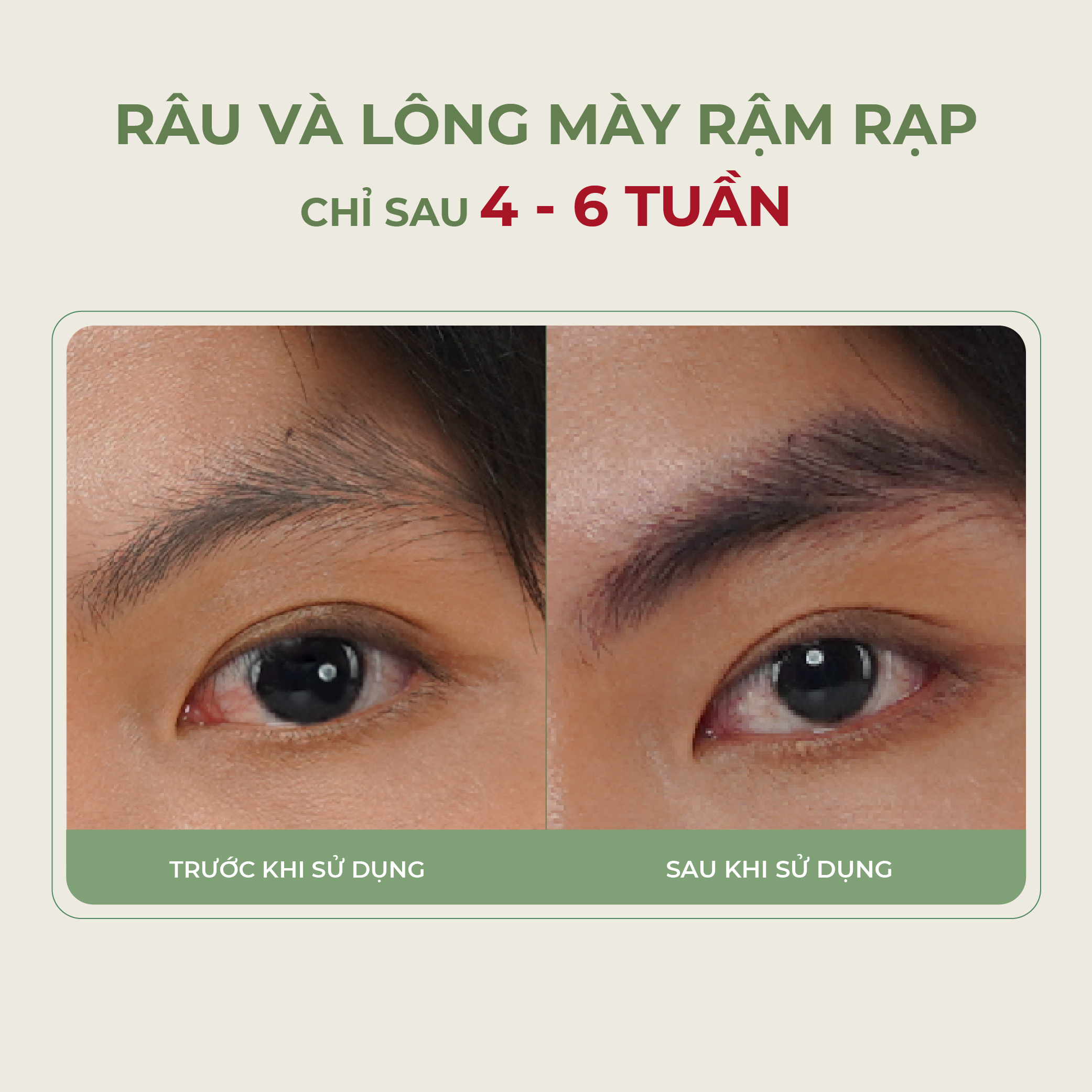 [Combo 2] Serum Kích Mọc Râu - Tóc - Lông Mày Abera Kích Thích Nang Lông, Nang Tóc Mọc Nhanh, Nuôi Dưỡng Cho Lông