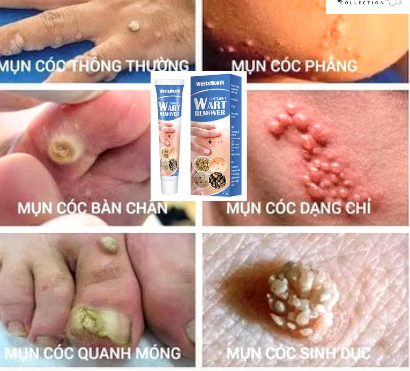 KEM TẨY XÓA MỤN CÓC MỤN THỊT CỰC NHANH CAM KẾT HIỆU QUẢ HÀNG LOẠI TỐT