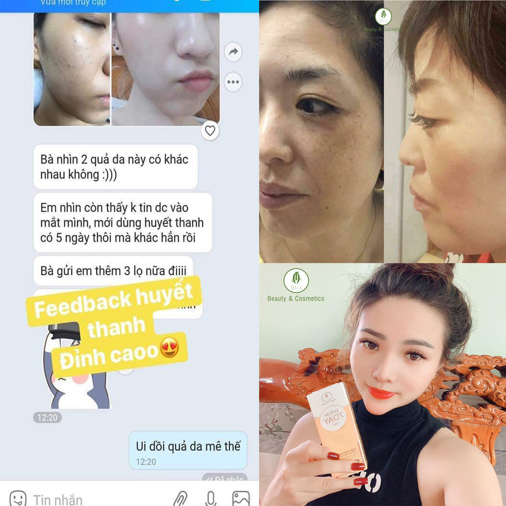 [CAM KẾT CHÍNH HÃNG] COMBO 5 lọ Serum 7 DAY OLIC (HUYẾT THANH TRUYỀN TRẮNG 7 DAY) giúp TRẮNG DA, NÂNG CƠ, TRẺ HÓA DA, trẻ hóa da từ 5~10 tuổi. (Tặng thêm 1 lọ serum và 1 sữa rữa mặt sữa chua cao cấp giúp sạch da, sáng da)