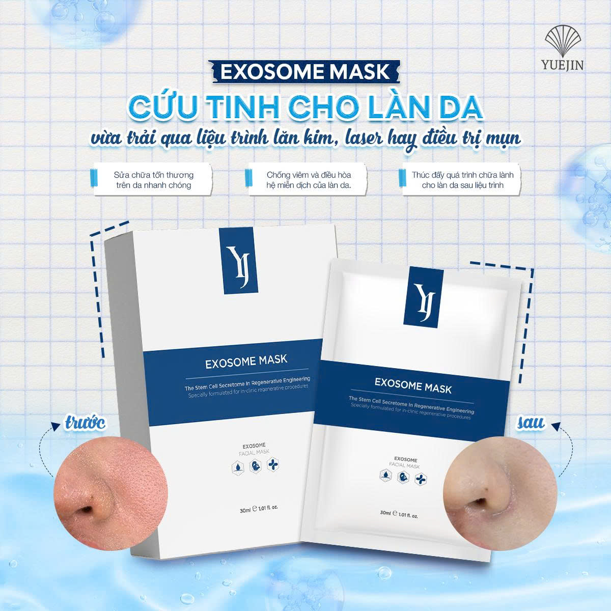 Mặt nạ tế bào gốc Exosome Cho Da Nhạy Cảm, Yuejin hộp 10 miếng, chống lão hóa, tăng cường độ đàn hồi