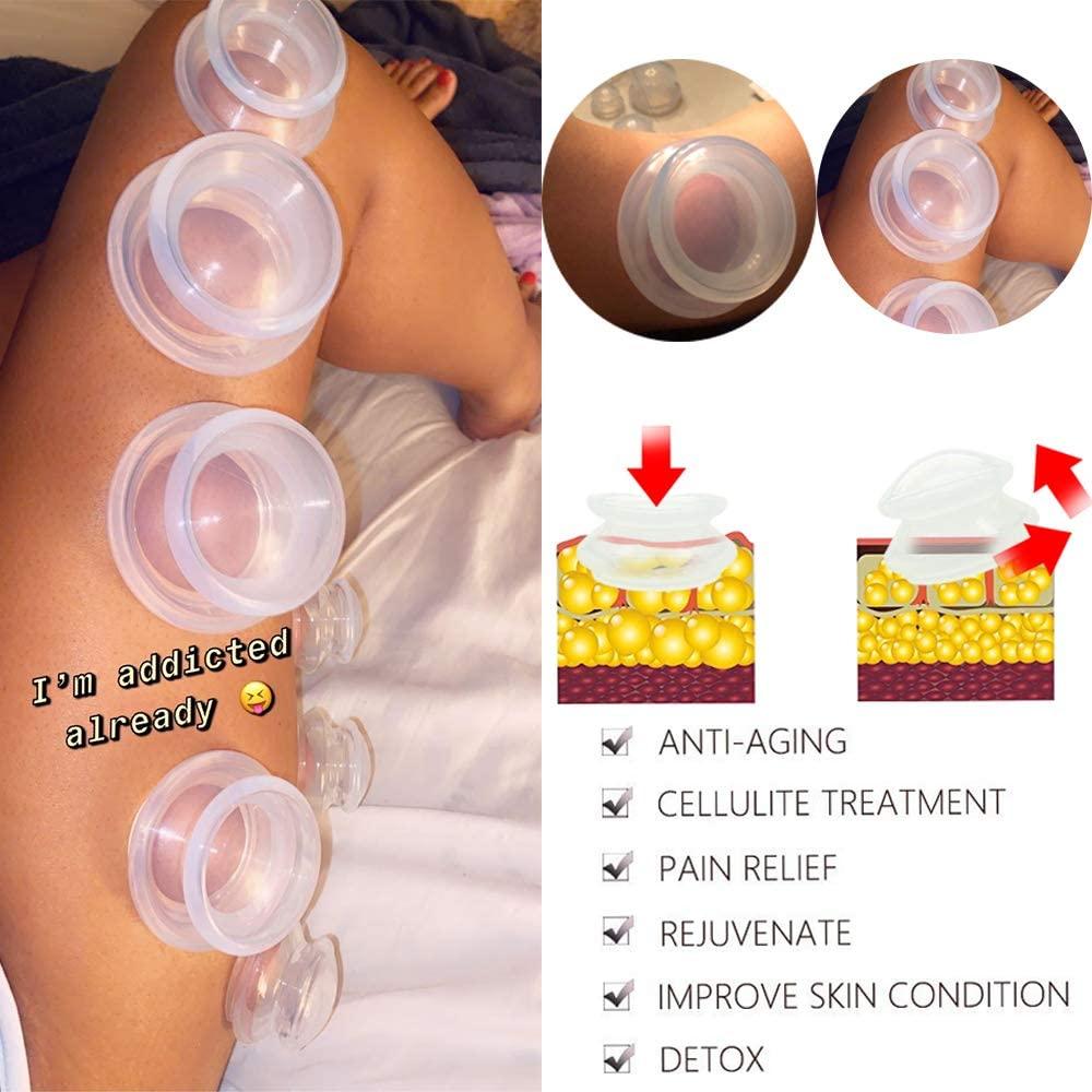 Bộ giác hơi trị liệu 4 kích cỡ - Studio và Home Silicone Cupping