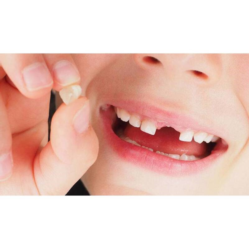 Hộp đựng răng sữa cho bé bằng gỗ để lưu giữ làm kỉ niệm