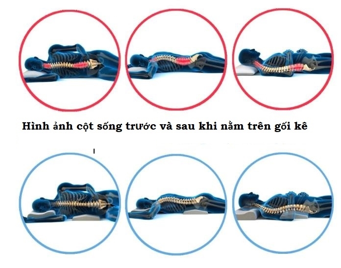 (Bộ 2 ) Gối bảo vệ cột sống cổ và gối kê thắt lưng khi ngủ