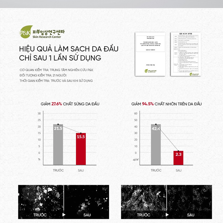 Dầu gội giảm rụng tóc Dr.ForHair phục hồi hư tổn nang chân tóc và kích thích mọc tóc - DR.FORHAIRFolligen Plus Shampoo 100ml