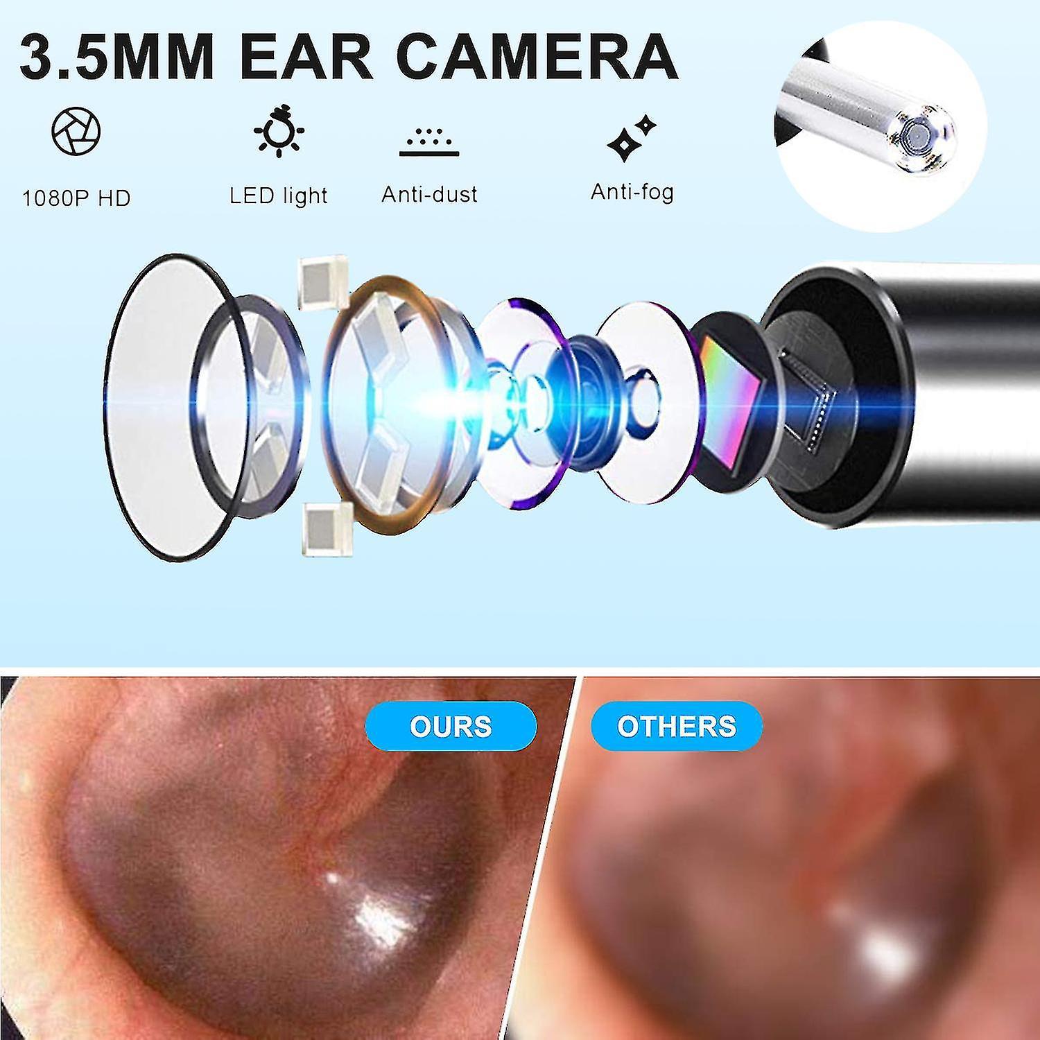 Dụng cụ lấy ráy tai Smart Visual Gậy tai Nội soi Độ chính xác cao Earpick Camera Mini Máy soi tai Healt