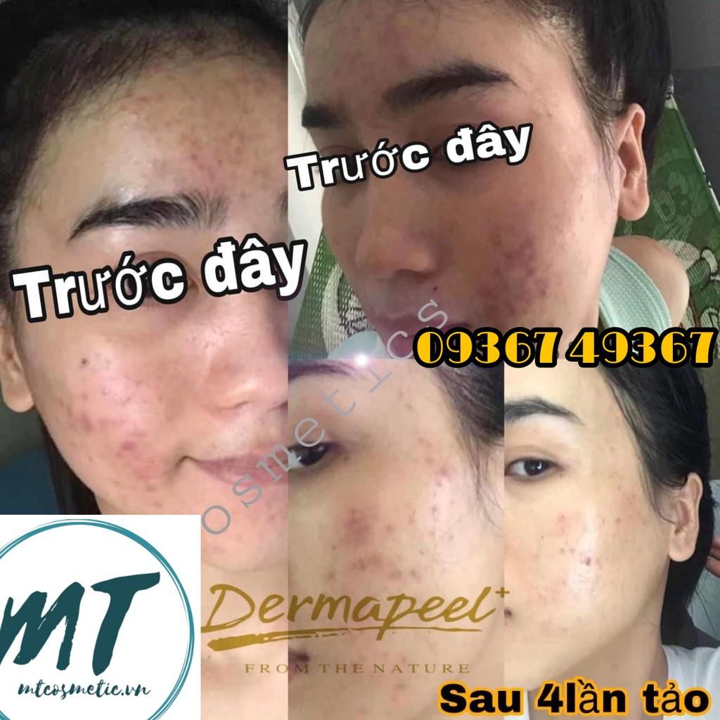 Vi kim tảo biển trứng cá tuyết Derma peel+ Skincare Total Solution - Vì Làn Da Hoàn Hảo