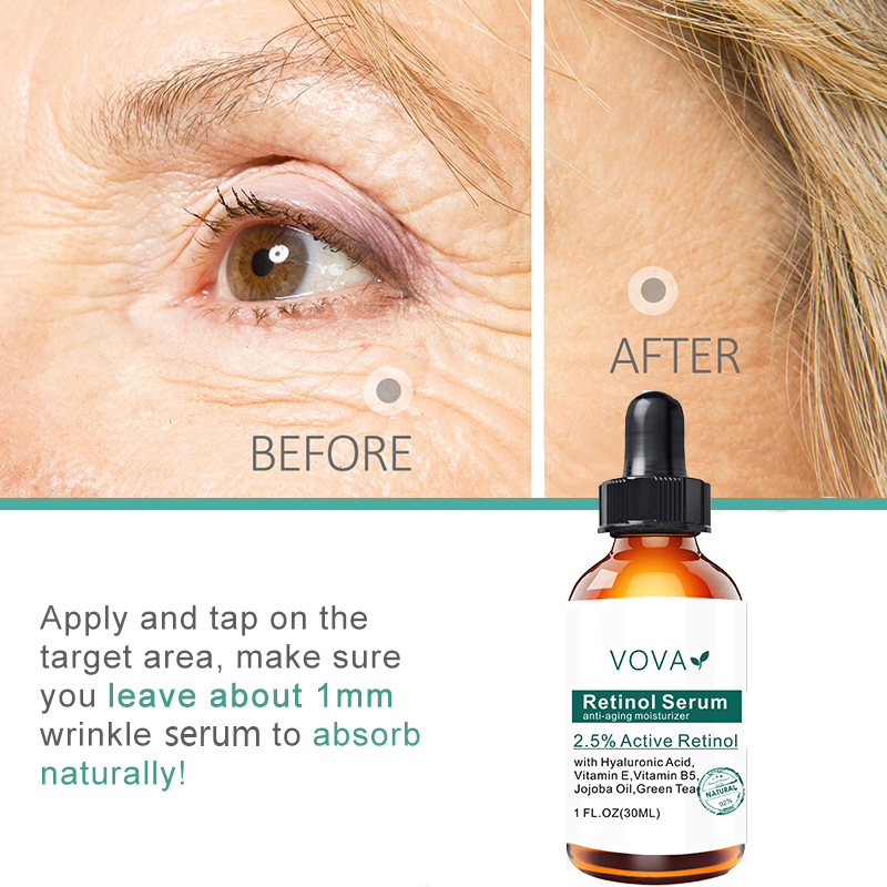 Serum xóa chân chim, nếp nhăn, quầng thâm, bọng mắt, thành phần Vitamin và thảo dược tự nhiên
