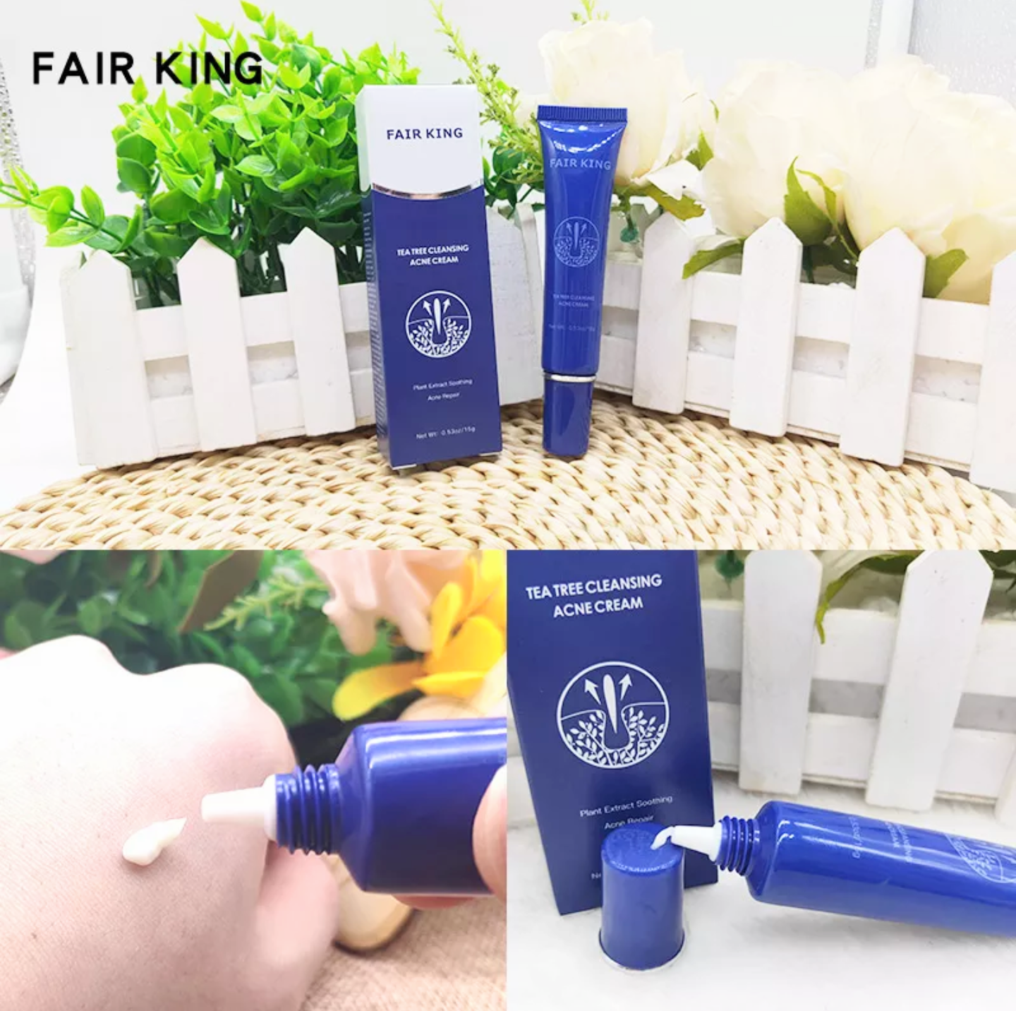 1 HỘP KEM TRỊ LOẠI BỎ MỤN LÀM MỜ CÁC VẾT SẸO TÀN NHANG DƯỠNG DA LÀM TRẮNG DA MẶT CAM KẾT HIỆU QUẢ HÀNG LOẠI TỐT