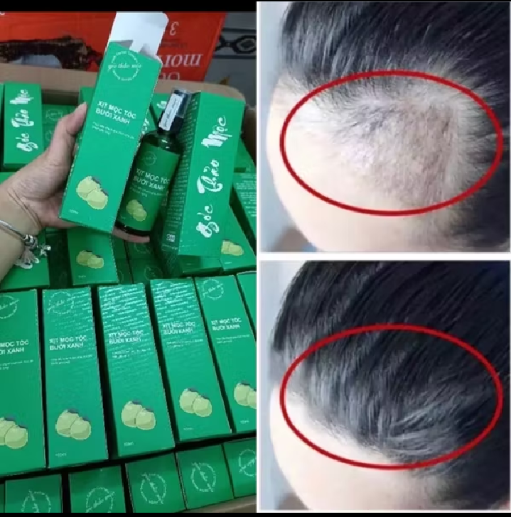 tinh dầu bưởi xịt kích thích mọc tóc loại tốt