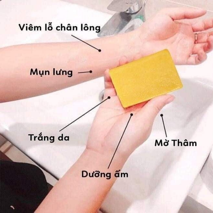 SINH DƯỢC SET 10 xà bông thiên nhiên Sinh Dược đủ 10 vị, xà phòng handmade Soap 100gr Organic hữu cơ thảo mộc tự nhiên sạch khuẩn ngăn ngừa mụn lưng, mặt, hôi nách viêm nang lông - GIATHANH STORE