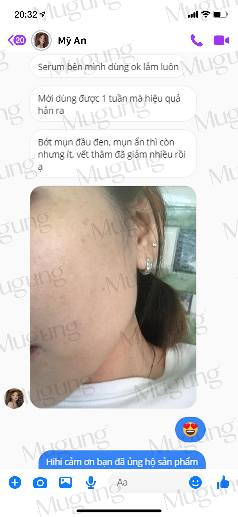 Kem dưỡng da Mugung Pure White Acne Cream chuyên dưỡng da giảm mụn,phục hồi và dưỡng trắng da,se khít chân lông xóa vết thâm mụn công thức độc quyền