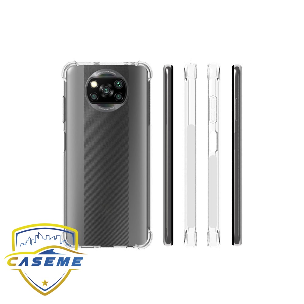 Ốp lưng dành cho Xiaomi Poco X3 dẻo trong chống sốc