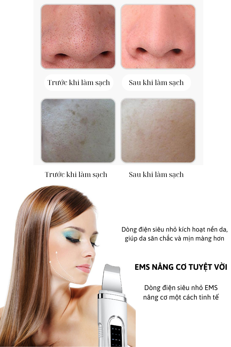 Máy Sủi Da Sóng Âm JOOU DS-8809 Tẩy Mụn Đầu Đen, Tẩy Da Chết, Thải Độc Và Dưỡng Ẩm Cho Da Ultrasonic Shovel