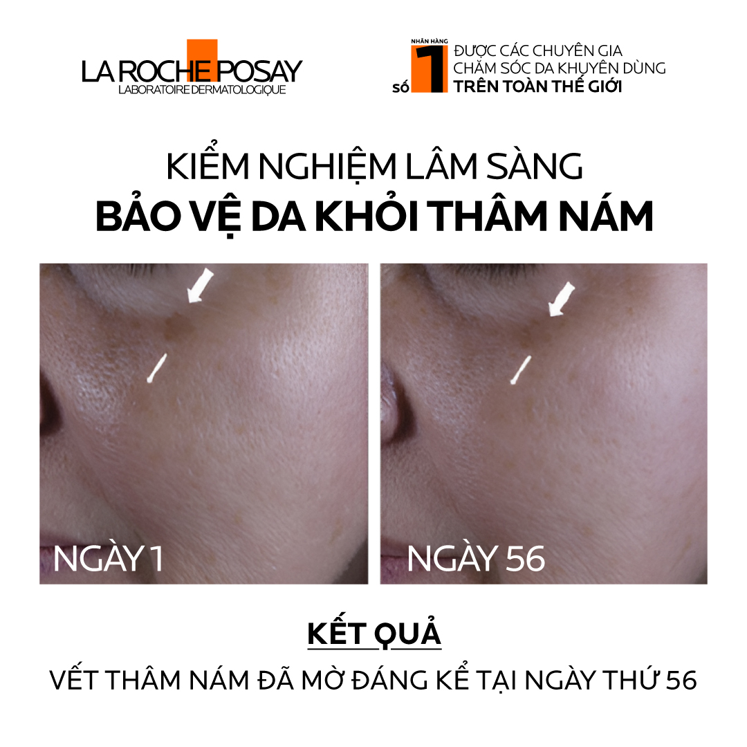 Sữa chống nắng dành cho da dầu mụn La Roche-Posay Anthelios UVMUNE400 Oil Control Fluid 50ml