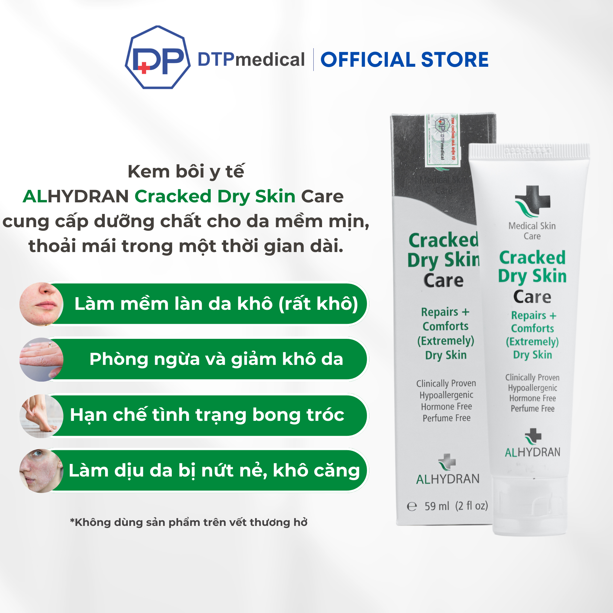 Kem bôi y tế ALHYDRAN Cracked Dry Skin Care phục hồi và làm dịu da bị khô nứt, cung cấp dưỡng chất ngay lập tức cho da