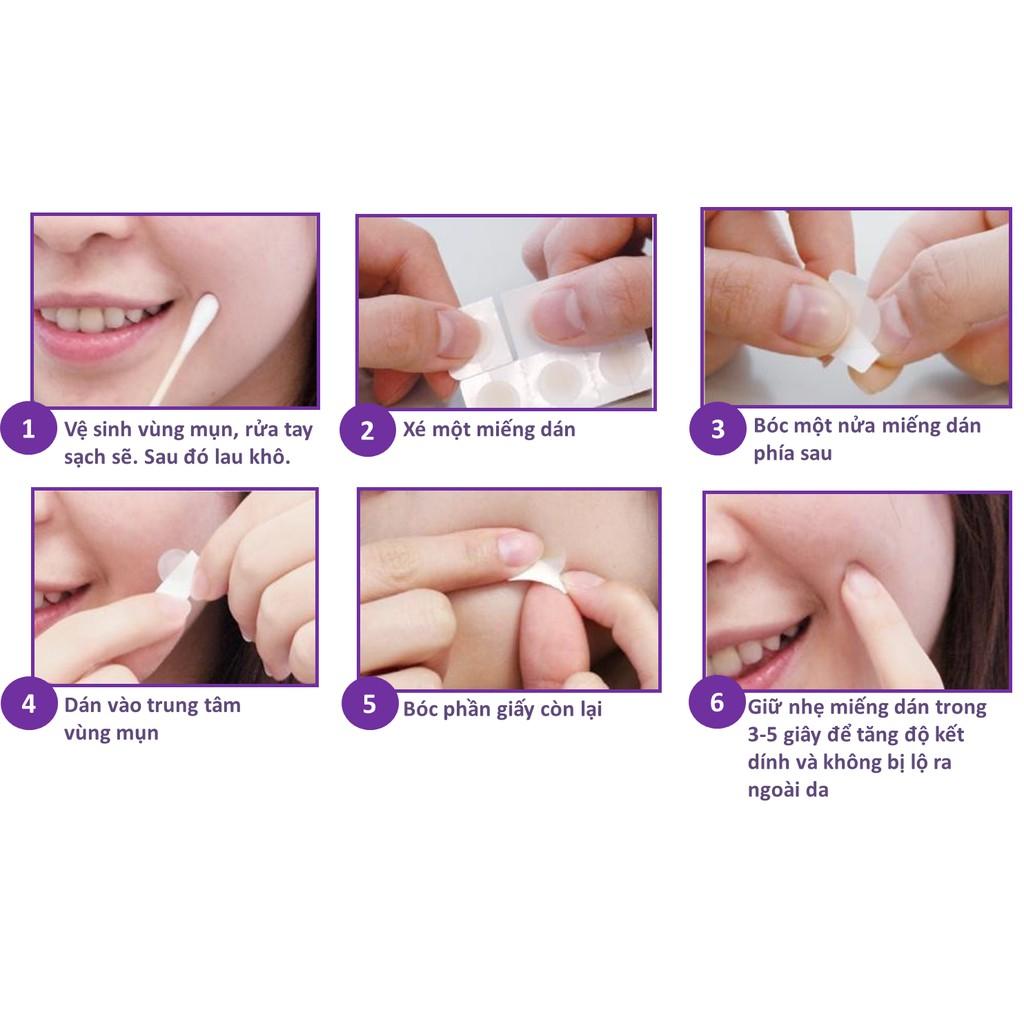 Miếng dán mụn Mayan Care Ultra Thin Spot