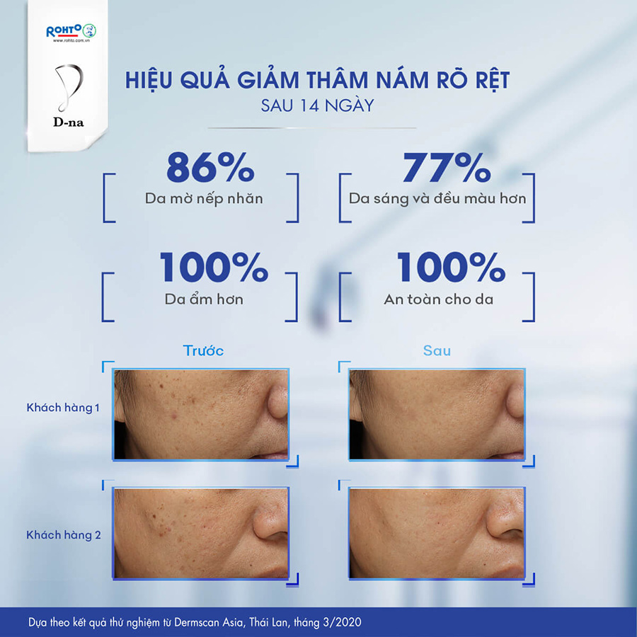 Viên uống sáng da D-na Whitening Supplement