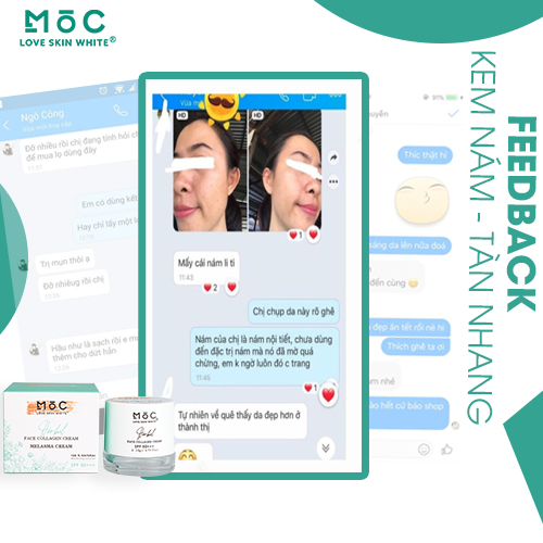 KEM NGỪA NÁM - TÀN NHANG, ĐỒI MỒI -COLLAGEN 20G - MỘC